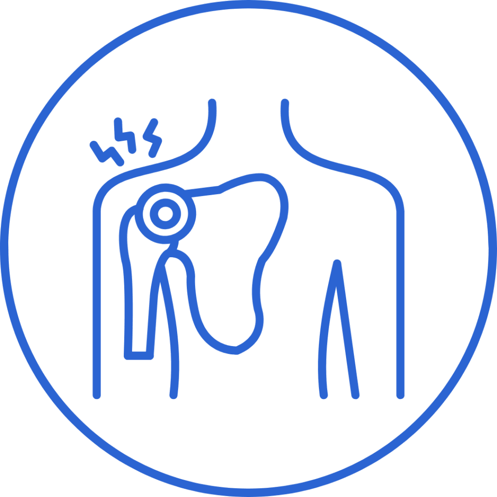 Imagen hombro curso manguito rotador,readaptación manguito rotador,curso readaptación,curso online,manguito rotador lesion